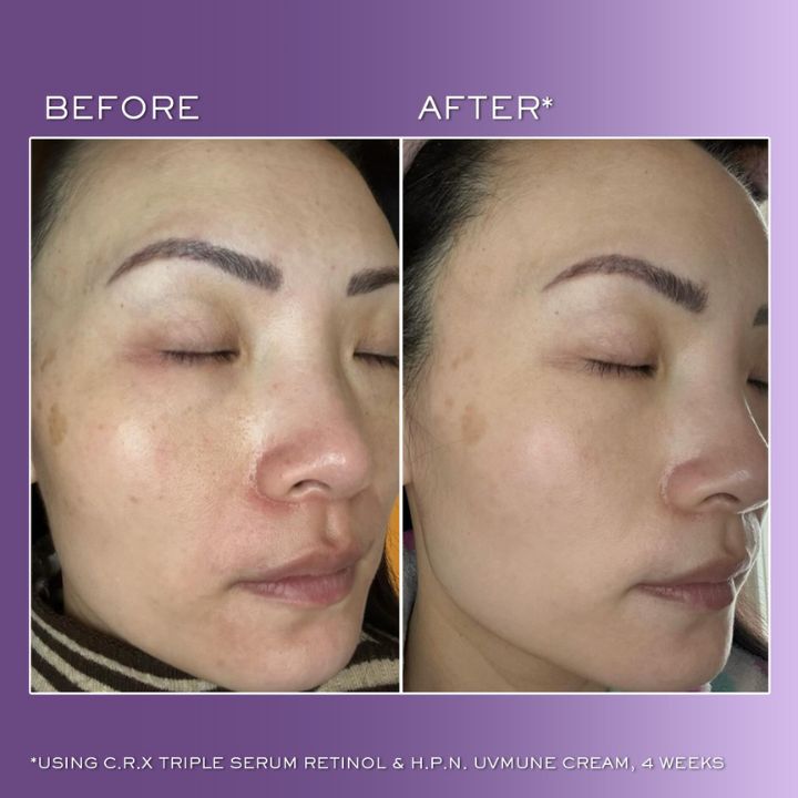 RENERGIE C.R.x. TRIPLE SERUM RETINOL